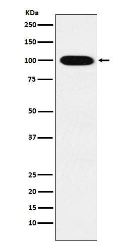 VPS18  Rabbit mAb