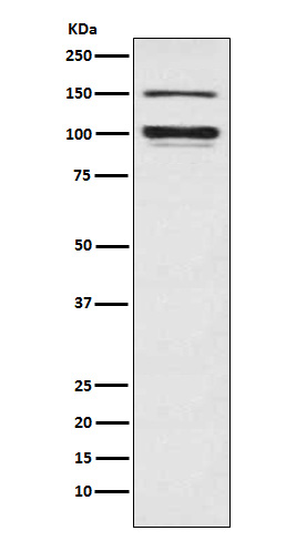 ATP1A3 Rabbit mAb