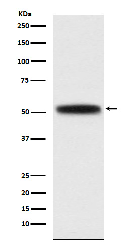 DGAT1 Rabbit mAb