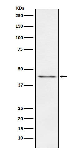 Carboxypeptidase A1+A2+B Rabbit mAb