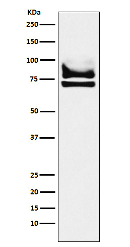 DDX17 Rabbit mAb