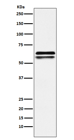 NAP1L1 Rabbit mAb