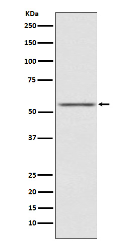 AMHR2 Rabbit mAb