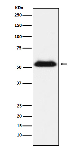 TMPRSS2 Rabbit mAb