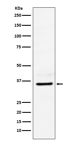 LDHB Rabbit mAb