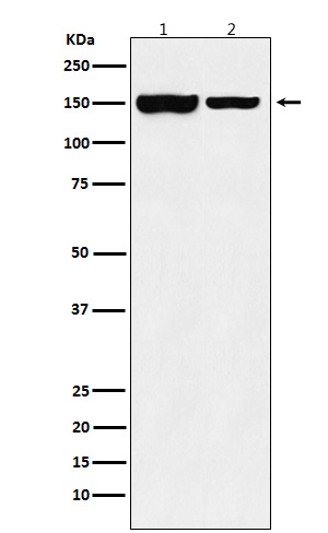 KDM4B / JMJD2B Rabbit mAb