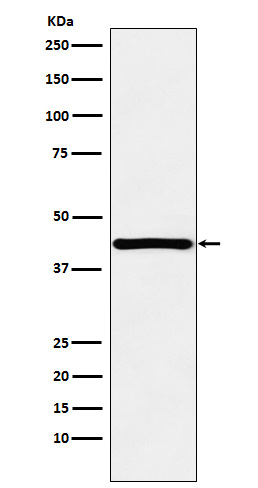 HOXA13 Rabbit mAb