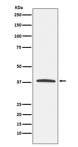 KLRG1 Rabbit mAb