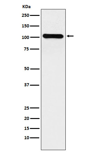 BACH1/BRIP1 Rabbit mAb