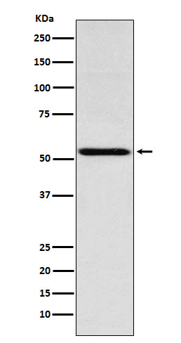 THRA Rabbit mAb