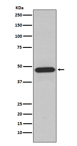 NCF1 Rabbit mAb