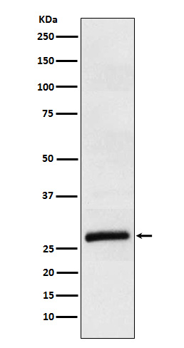 ApoM Rabbit mAb