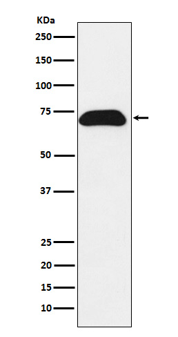 PDZK1 Rabbit mAb