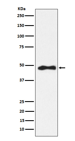 AP2 alpha Rabbit mAb