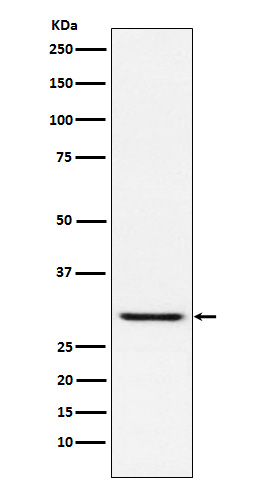 TIRAP Rabbit mAb