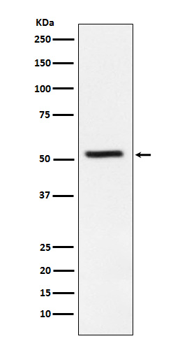 TrpRS Rabbit mAb