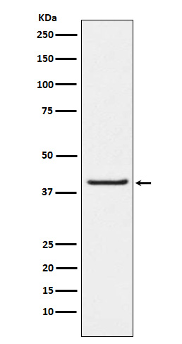 PAR4 Rabbit mAb