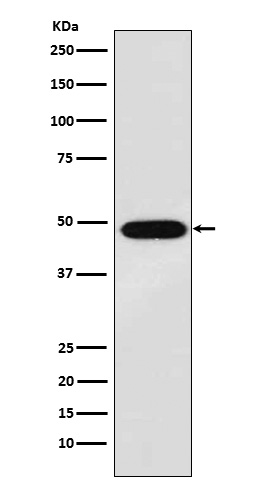 MAGE 1 Rabbit mAb