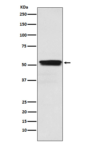 ACM2 Rabbit mAb