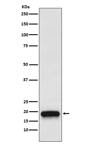 VEGFB Rabbit mAb