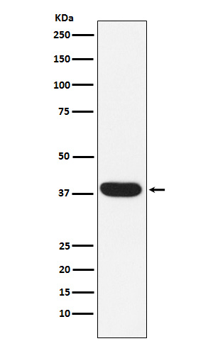 MYF5 Rabbit mAb