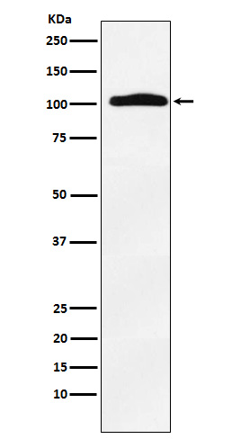 Thyroid Peroxidase Rabbit mAb