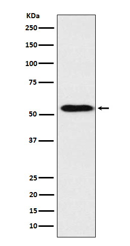 ApoH Rabbit mAb