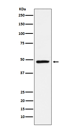 NR2E1 Rabbit mAb