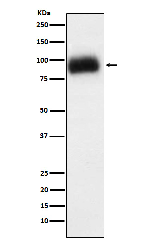 ADAM15 Rabbit mAb