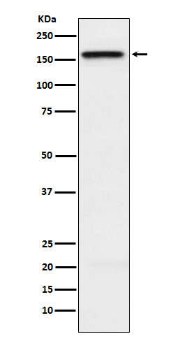 KIF4A Rabbit mAb