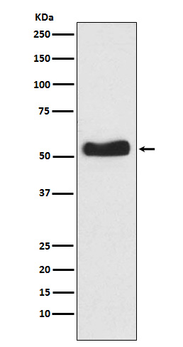 Glucokinase Rabbit mAb