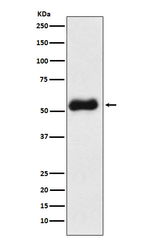 Thromboxane synthase Rabbit mAb