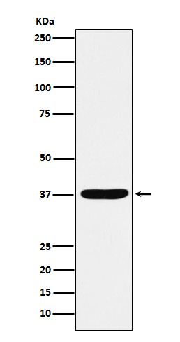 AKR1C1 / AKR1C2 Rabbit mAb