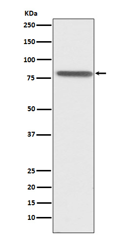 PSAP Rabbit mAb