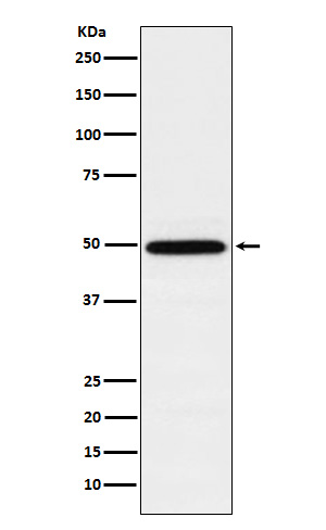 TIP49A Rabbit mAb