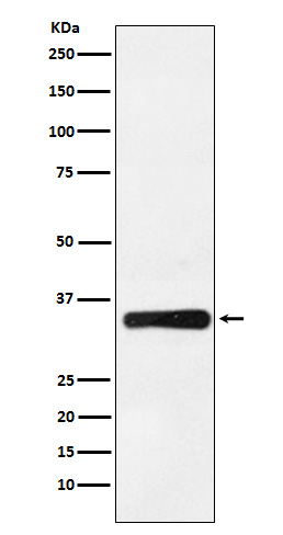 HOXB4 Rabbit mAb