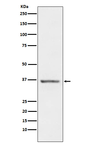 STC1 Rabbit mAb