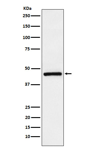 TMEFF2 Rabbit mAb