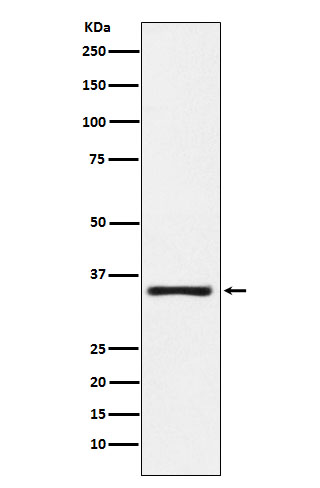 KLK2 Rabbit mAb