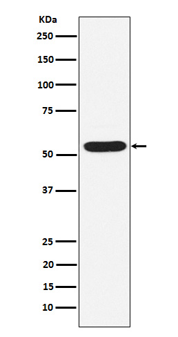 PIAS2 Rabbit mAb