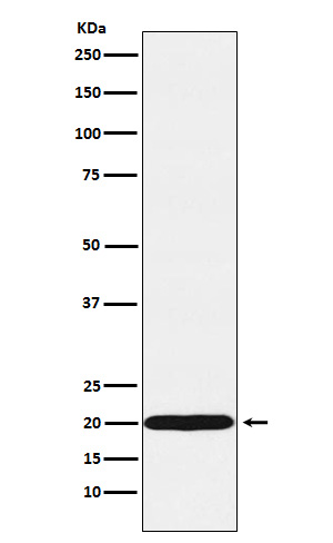 UBE2C Rabbit mAb