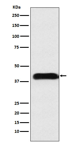 M6PR Rabbit mAb