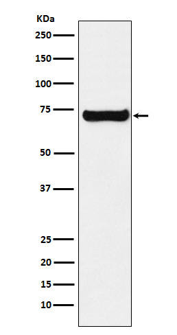 SESN1 Rabbit mAb