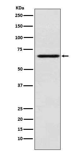 MADCAM1 Rabbit mAb