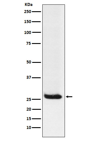 Hippocalcin Rabbit mAb