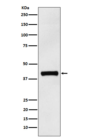 IL12 p40 Rabbit mAb