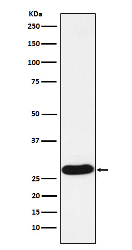 PR3 Rabbit mAb