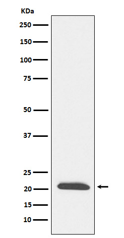 DCTN3 Rabbit mAb