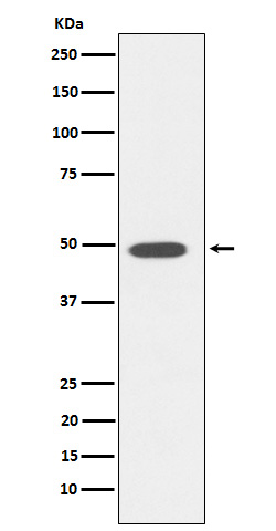 DP1 Rabbit mAb