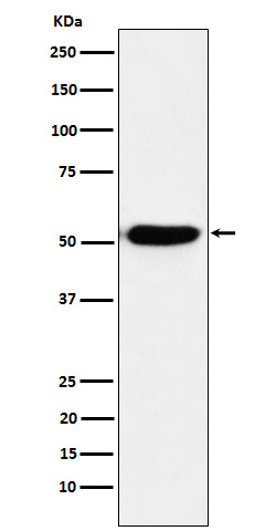 IRF4 Rabbit mAb